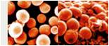 lipodystrophie